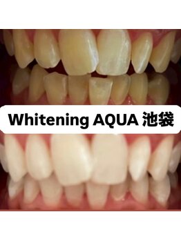 アクア 池袋店(AQUA)/ホワイトニング/池袋/東京/美白