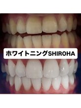 シロハ(SHIROHA)/セルフホワイトニング/天王寺