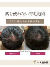 コレア整体院(COREA整体院)/ 再生育毛促進術