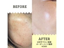 プリエ(Prier)の雰囲気（1番人気メニュー♪60分やりたい放題オーダーメイド施術）