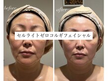 トータルビューティーサロン シャンディール(Chandeel)の雰囲気（コルギフェイシャルで小顔に！リフトアップ・二重顎・たるみ改善）