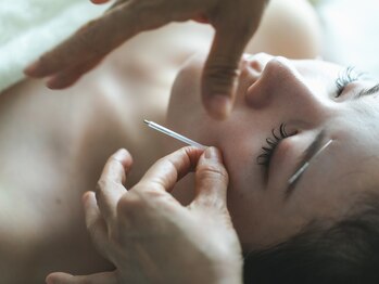 ハリスト(HARIST)の写真/《理想の小顔が手に入る》結果重視の実力派サロン”美容鍼”でお顔の筋肉をほぐして美肌・小顔に導きます♪