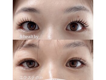 ソフ 津店(SOFS)の写真/若見え叶う！瞳の影がなくなり視界広がる、魔法のようなモテ可愛EYE☆
