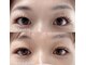 ソフ 津店(SOFS)の写真/若見え叶う！瞳の影がなくなり視界広がる、魔法のようなモテ可愛EYE☆