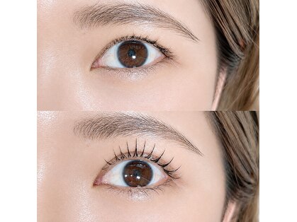 ビニー(binny)の写真