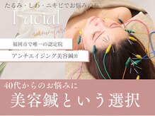 オンケイ(ONKEI)