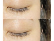 リリィ(Riliy)/フラットラッシュ100本