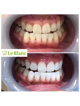 ルブラン 奈良店(Le Blanc)/見違える白さに!!