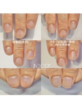 ニコプラス(NICO+)/自爪育成中