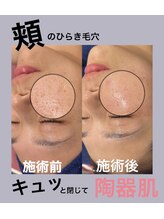 シャルム(CHARME)/フェイシャルも得意！