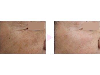 ノンノン(NonNon)/若々しい見た目へ