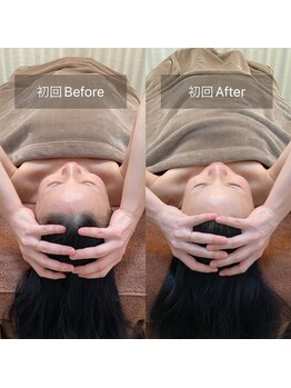 スリージー/before/after