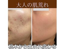 ファシル(Facile)の雰囲気（お悩み改善+癒しの空間ご用意させて頂きます。）