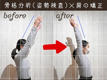フォーユー 和歌山北島院(foryou)/Before→After2