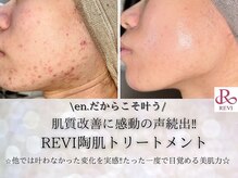 エン(en.)