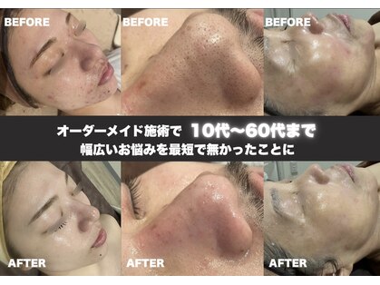 レア 姫路店(le'a)の写真