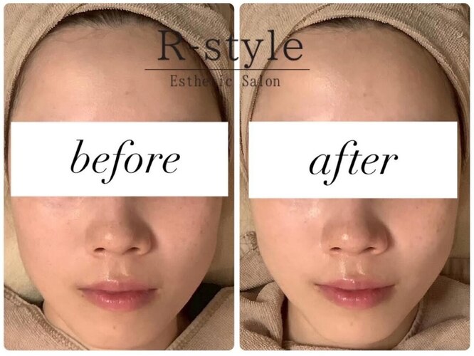 エステサロン アールスタイル(R-style)｜ホットペッパービューティー