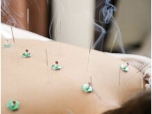 アノン 松山(Anon)/全身調整