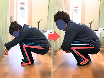 杉本接骨鍼灸院/専門機関で改善されなかった