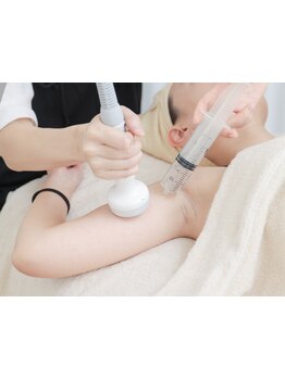 サイズダウンを目指したい