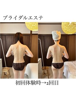 イム(I'm.)/ブライダルエステ