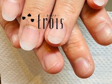 トロワ 中目黒(trois)/上が矯正後、下が矯正前のお爪。