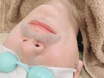 シュエット(chouette)の写真/メンズヒゲ脱毛！青髭など男性特有のお悩み解消で清潔感も一気にUP◎ヒゲだけではなく全身の脱毛も可能です