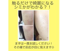 ヒーリングサロン ユルリ(YURURI)の雰囲気（ごまかしメイクにサヨナラ！シミケア初回体験￥19,800→￥7,800）