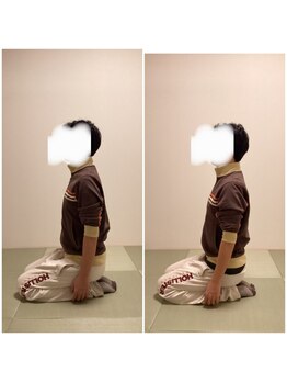 ツリー鍼灸整骨院 吹田店(TREE鍼灸整骨院)/ストレートネック改善に！