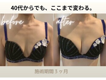 ハリスタ 京橋院(HARISTA)/BEFORE AFTER　【40代の方】