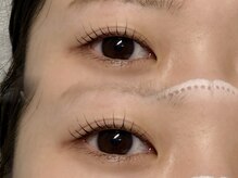 ジュベアイラッシュ 別府店(juve. eyelash)/UPforcelift