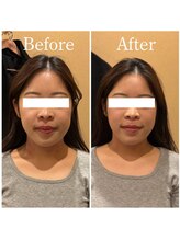 アキュレ(Acure)/