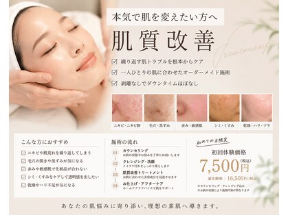 シュシュ(Chou Chou)の写真