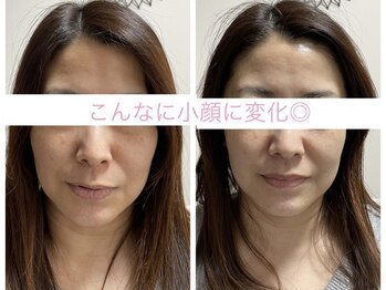 サクラ(SAKURA)/若々しい見た目を求めるならコレ