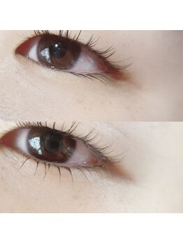 ニコプラス(nico+)/逆さまつげ改善