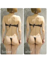 インディバ 六本木/インディバ六本木/首肩こり/腰痛