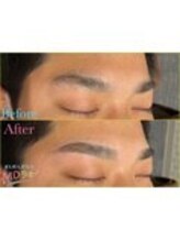 MDラボ 小松清六店/before after