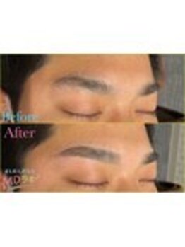 MDラボ 小松清六店/before after