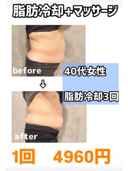 スリム(SLIM by lily of the valley)/1回4960円