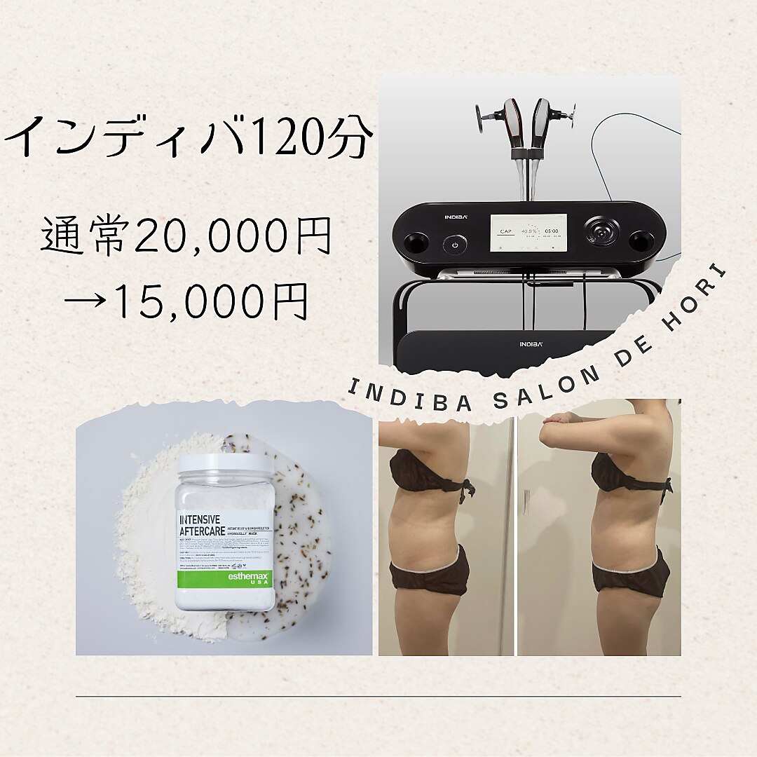 INDIBA インディバキャパ インディバサロン(INDIBA SALON 8296)｜ホットペッパービューティー