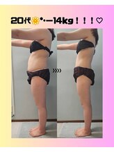 ルミルナ(Lumi Luna)/20代ダイエット