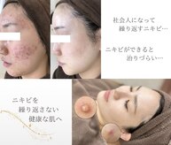 エピア 半田店(Epia)