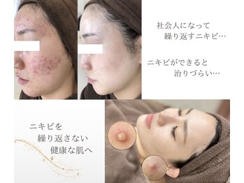 エピア 半田店(Epia)