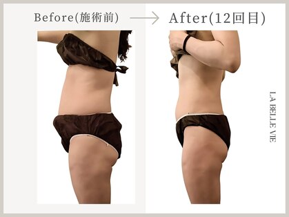 ラベルヴィ(La belle vie)の写真