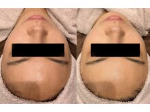 ビュウナ 銀座(BEAUNA)/シルクブライト