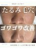 【肌を擦らない】肌を根本から育てるハーブピーリング 120分 