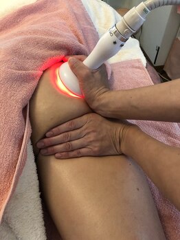 ベルマーノ 天神店/お悩み相談の多いセル撃退