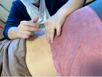 グリーム鍼灸院の写真/痛み・疲労でつらいお身体の不調を整え、治癒力を高める"鍼灸ケア"による根本改善★短時間で疲労回復♪