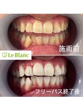 ルブラン 奈良店(Le Blanc)/フリーパスコースがおすすめ！