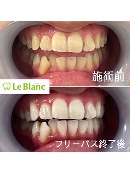 ルブラン 奈良店(Le Blanc)/フリーパスコースがおすすめ！